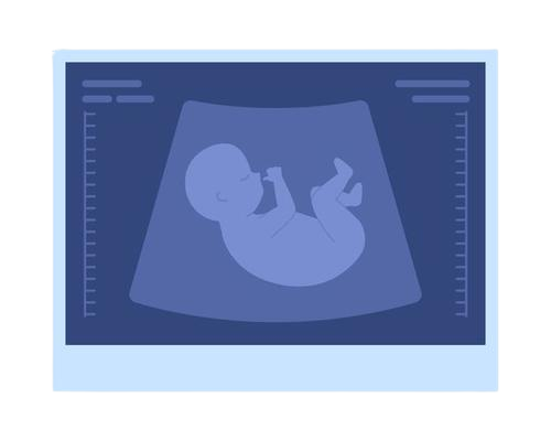 Gender scan Amman Gender scan Amman